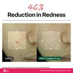 Dr.G R.E.D Blemish Clear Soothing Cream 70ml - Image 4