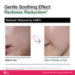 ANUA Heartleaf 80% Soothing Ampoule 30ml - Image 3