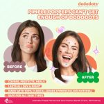 Dododots DodoSkin Full Range Pimple Patch Bundle – 5 Sets / 180 Patches - Image 8