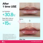 Anua PDRN Lip Serum 10ml - Image 4