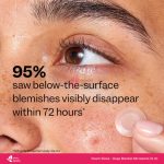 Peach Slices Deep Blemish Microdarts – 9 Patches - Image 6