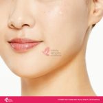 COSRX AC Collection Acne Patch – 26 Patches - Image 8