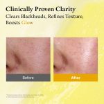 FULLY Lemon Vita Bubble Mask Cleanser 150 ml - Image 5
